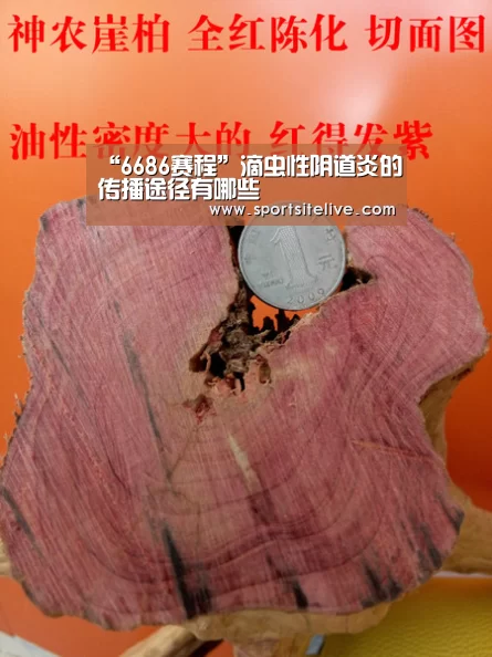 “6686赛程”滴虫性阴道炎的传播途径有哪些(图1) 6686下载